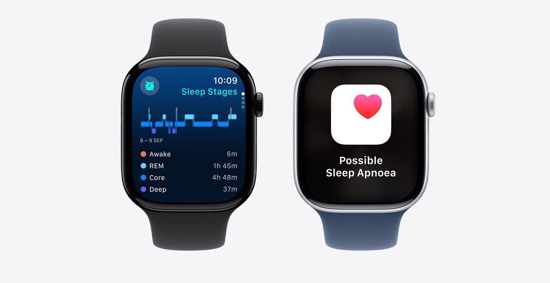 Two Apple Watch Series 10. The first shows Sleep Stages data. The second shows a Possible Sleep Apnoea notification.